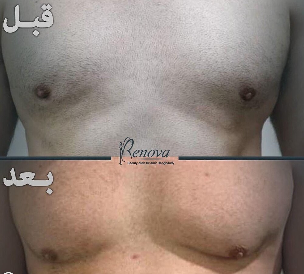 Clinic Results Gallery